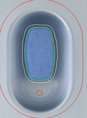 alu-alu pocket defect