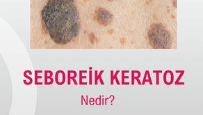 Seboreik Keratoz Nedir? Belirtileri ve Tedavisi