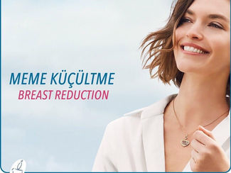 meme küçültme kocaeli 