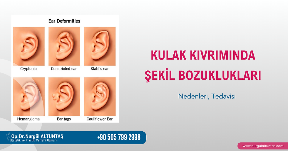 kulak kıvrımı bozukluğu