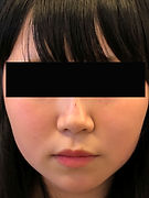 HP用 カベリン目隠し 施術後目隠し改.jpg