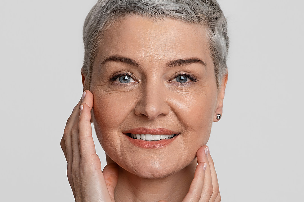 qualite peau biostimulation Radiesse hyperdilue Lausanne fibroblastes collagene