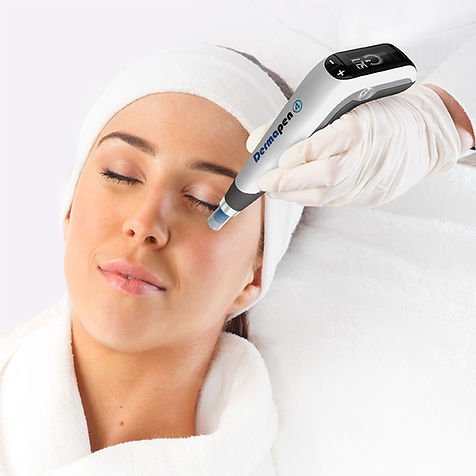 Traitement de microneedling Dermapen 4 sur le visage – alternative sûre à la radiofréquence microneedling RF