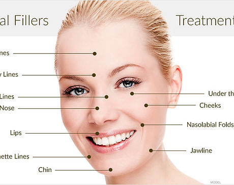 真皮填充剂治疗区域