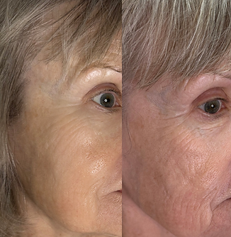 Professional facial treatments in Round Rock by licensed esthetician