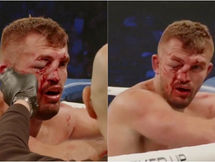 Kyle Redfearn’s Grit Shines as Doctor Stops BKFC 68 Fight Due to Facial Injuries