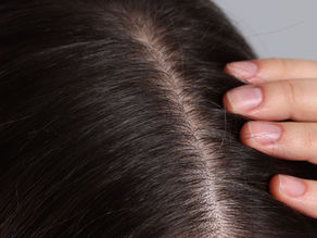 The Importance of Scalp Care: Why Your Scalp Ages Faster Than Your Face