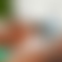 A client getting an IV drip while working