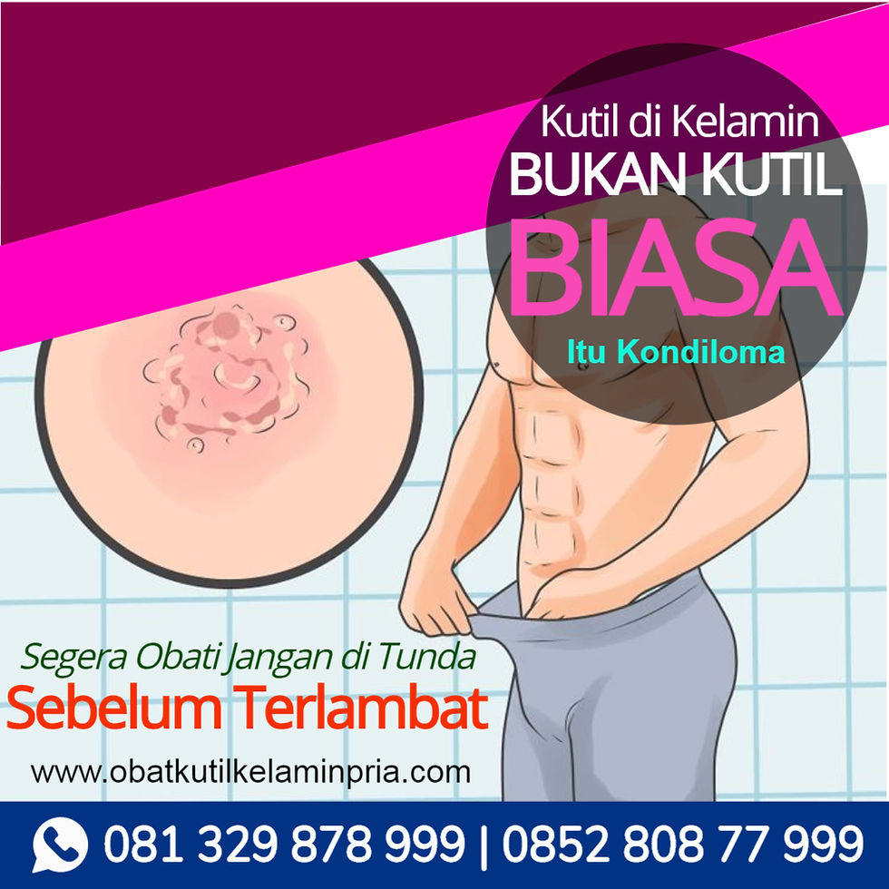Bagaimana Cara Mengatasi Kutil Kelamin