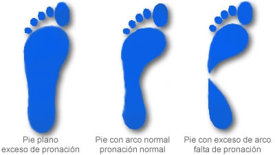 Tipos de Pies