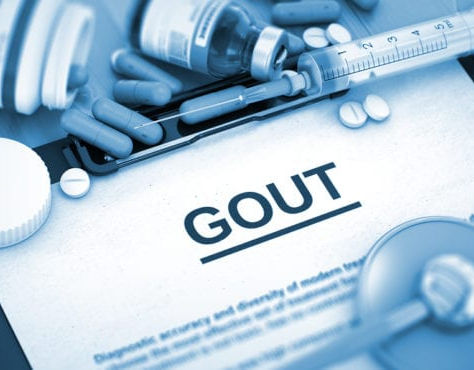 How Long Will Dad’s Gout Last?