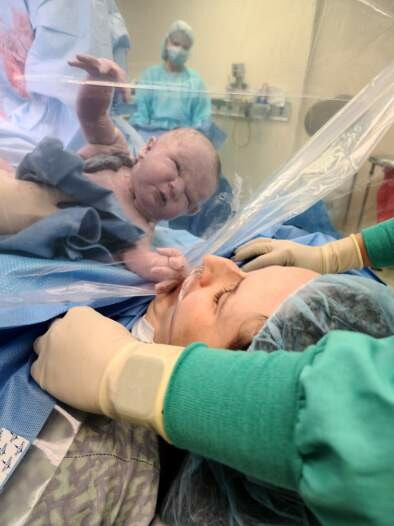 Gentle c-section performed by Dr. Stephanie Allen in Athens, Ga. External version was unsuccessful.