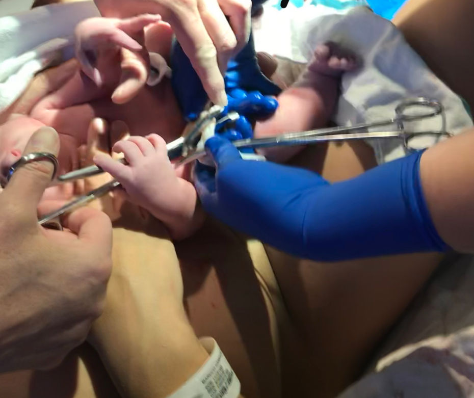 Cutting the umbilical cord, baby takes scissors to help