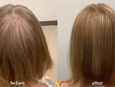 ted Before and after.jpg