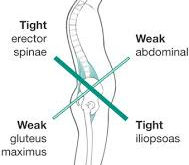 Understand your low back pain!
