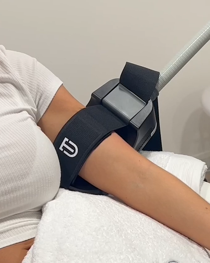 Arm Reshape