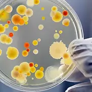 microbes-620_620x350_71480155886.webp