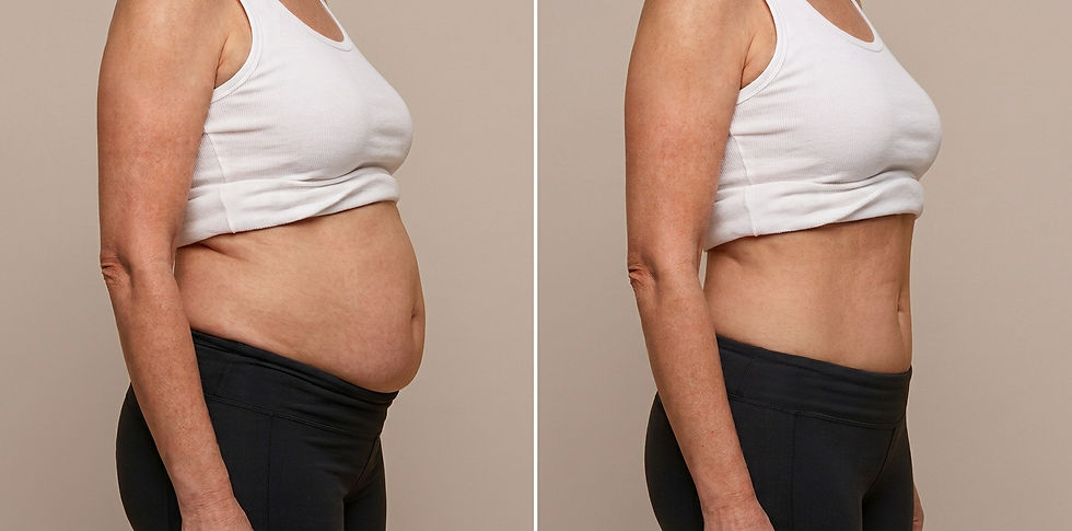 Aqualyx Guide 2026: The Medical Guide to Fat Dissolving Injections