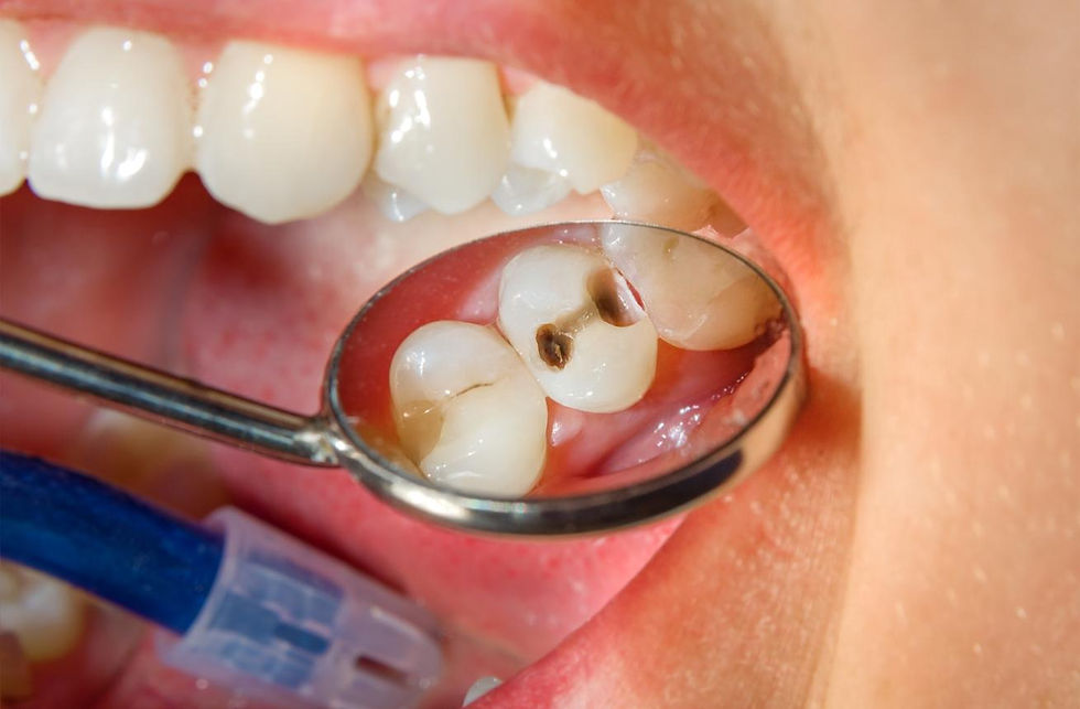 tooth replacement options - dental implants vs dentures