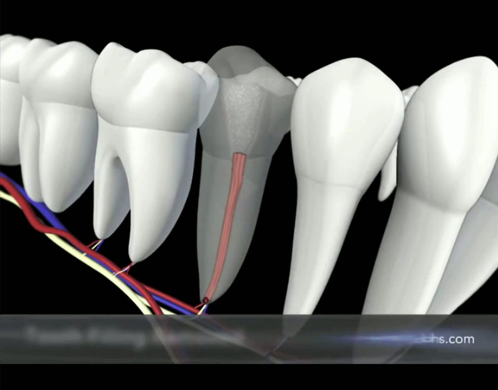 26 - endodontic retreatment video.mp4