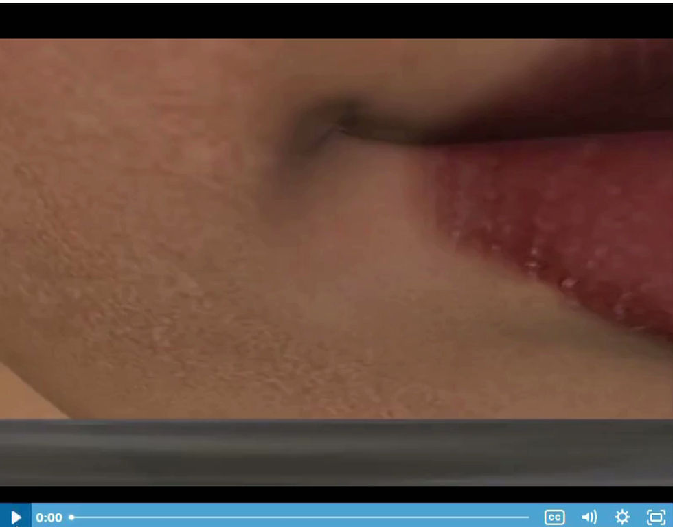 24 - root canal video.mp4