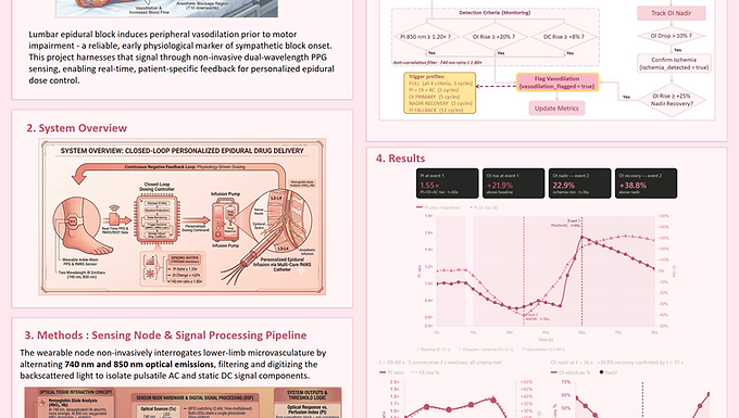 Personalized Epidural Dosing by Smart Negative Feedback System
