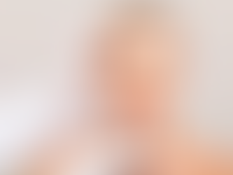 Bảng giá căng chỉ da mặt mới nhất năm 2024