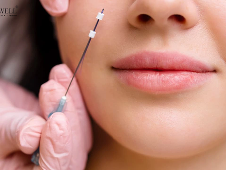 Chỉ Collagen Căng Da Mặt Có Hiệu Quả Như Thế Nào?