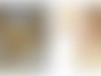 Căng da mặt bằng chỉ vàng có tốt không?