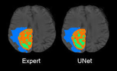 segmentation_med.jpeg
