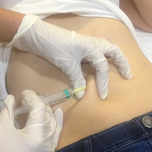 mesoterapia.JPG