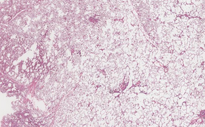 Fascia: the structure that unites the east and the west.