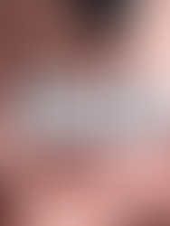 How Does an Individual Perceive Pain?