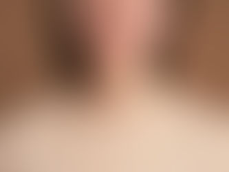 Portrait of a woman with visible skin texture, representing ongoing acne cycles.