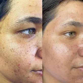 zena_algae_peel_at_skin