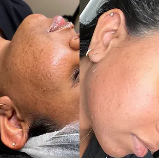 zena_algae_peel_at_skin