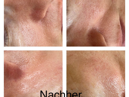 Gesichtsbehandlung mit Naturkosmetik