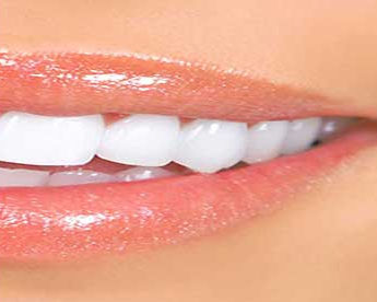 TEETH WHITINING