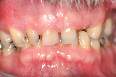 Patient 6 Before