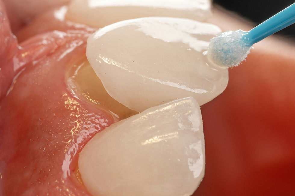 Close-up of white teeth being cleaned with a blue swab, with pink gums in warm light.