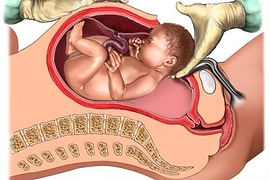 Jennifer+Mercier+can+help+with+C-Section
