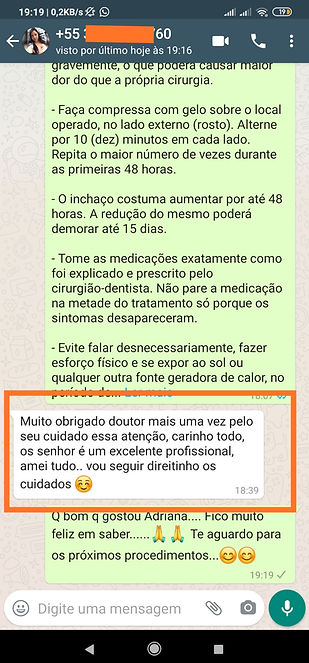 relato de bichectomia com dr filipe shimodo
