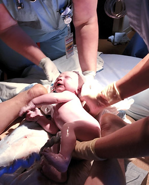 Baby being delivered