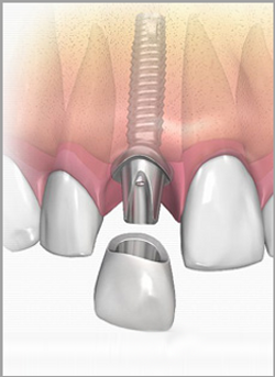 periodontics