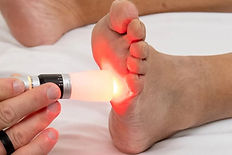 Neuropathy.laser.treatment.summus.medical.laser-1920w_edited.jpg