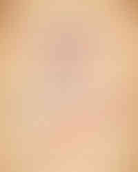 315298816_913276302995721_8049755314790810077_n