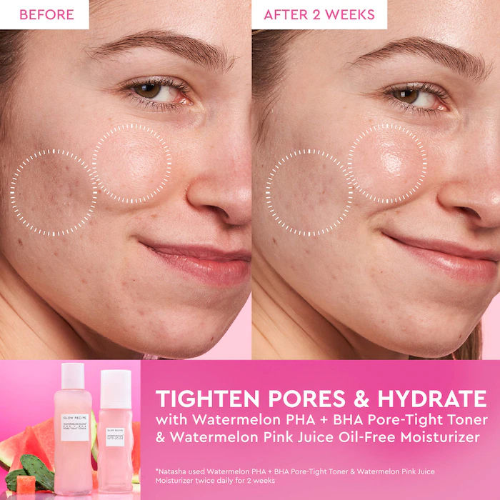 Thumbnail: Glow Recipe  Watermelon Pink Juice Oil-Free Refillable Moisturizer