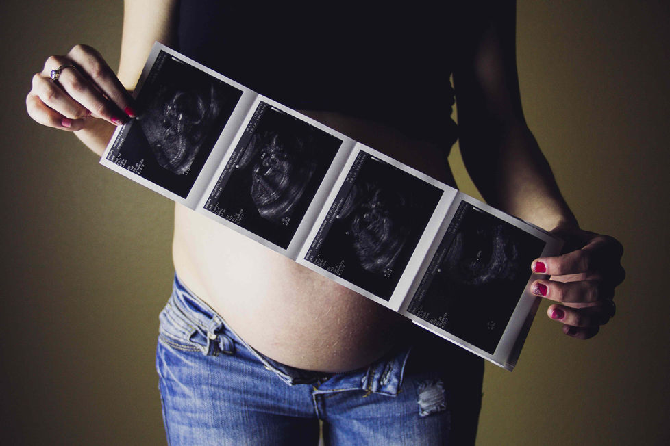 How chiropractic can help when expecting. 