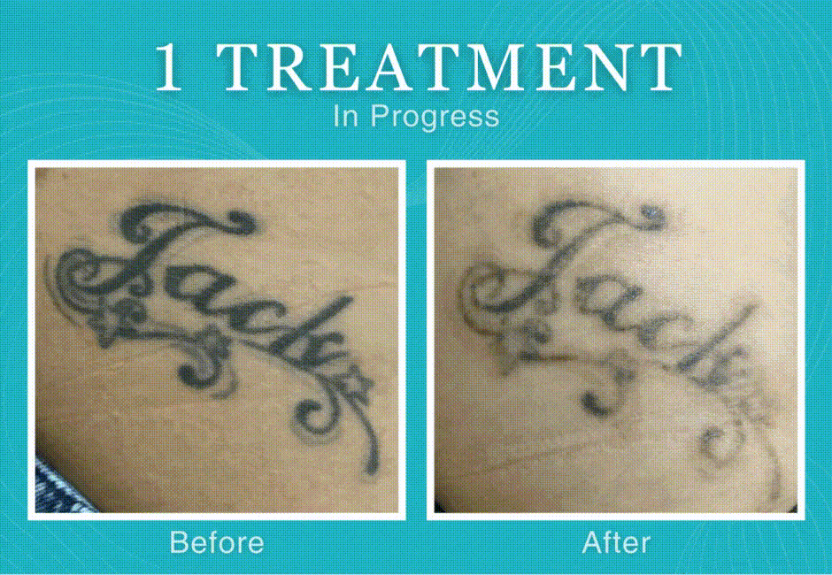 304 Hillbe Ng (1) gif cropped.gif