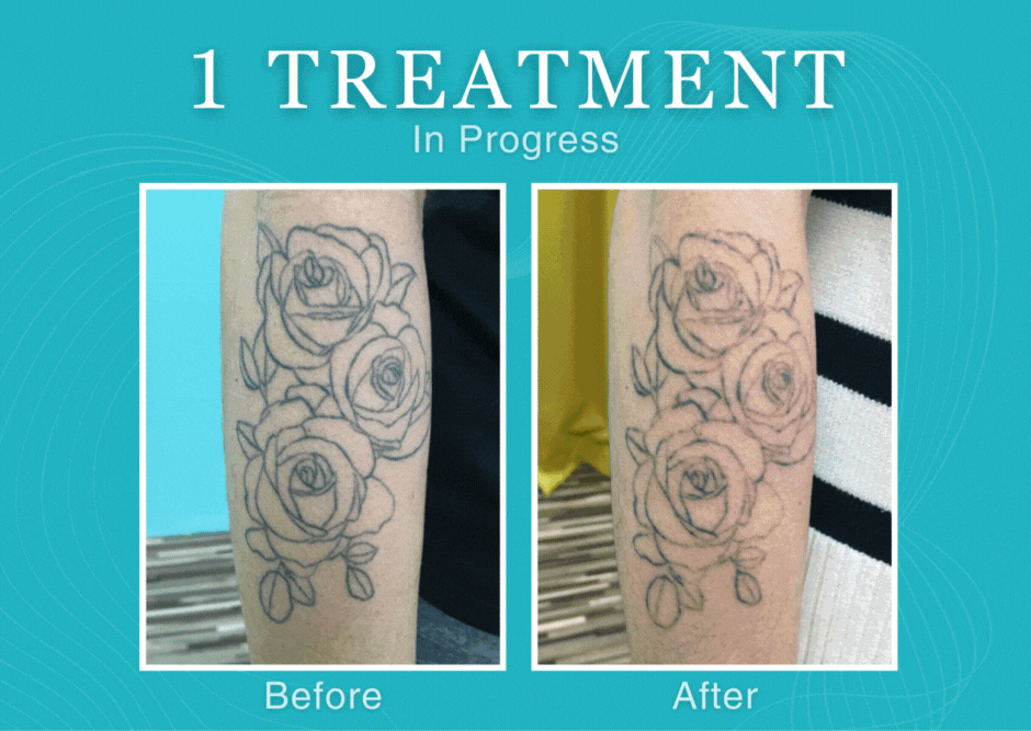 1236 SnowyBorghin2.gif